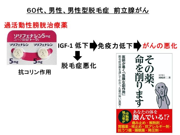 円形脱毛症　病院